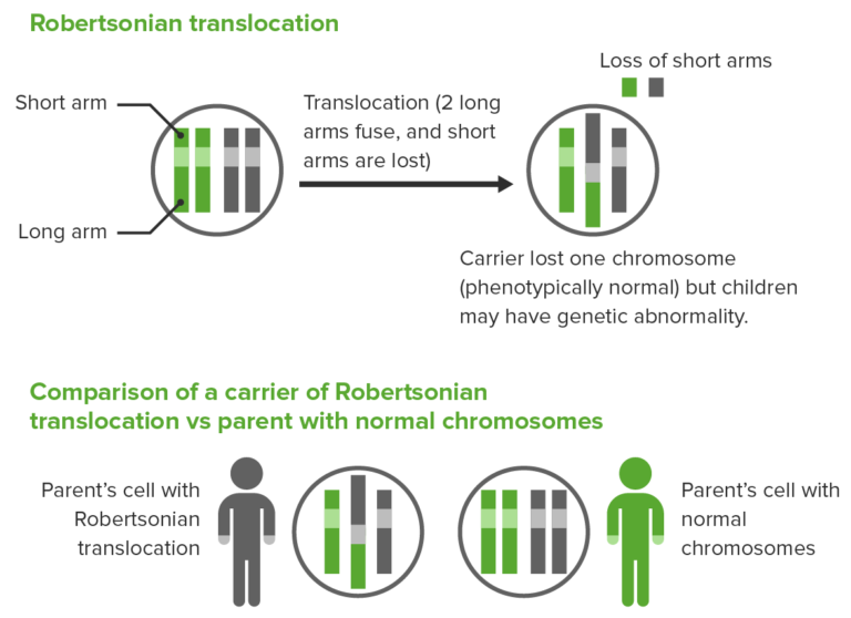 Patau Syndrome Trisomy 13 Concise Medical Knowledge 