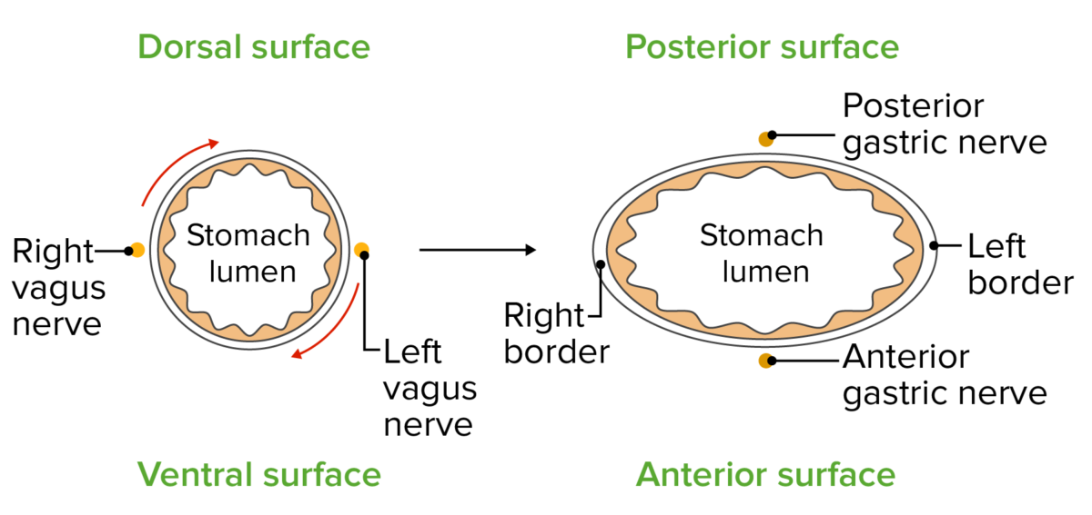 Rotation of the stomach