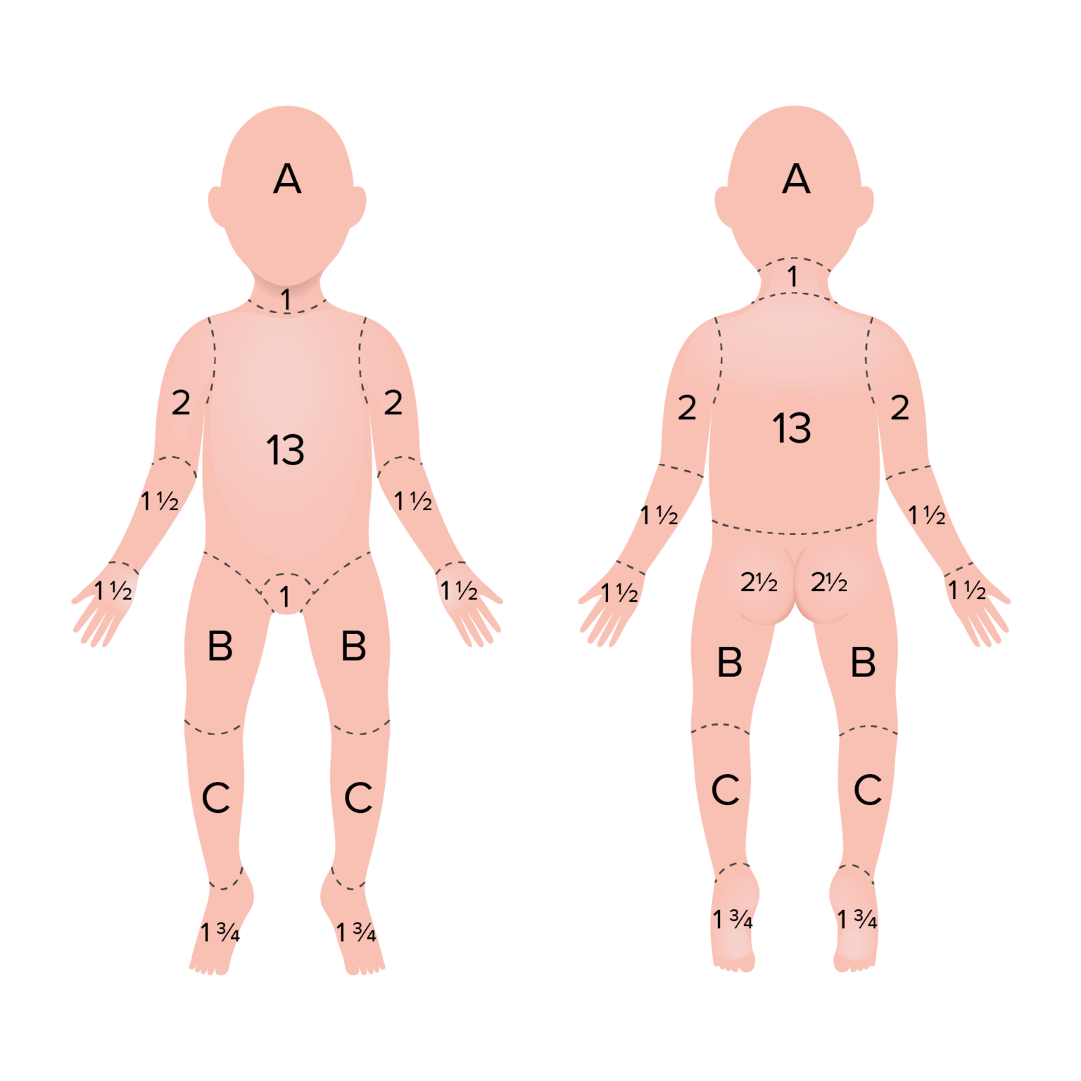 Burns: Classification [+ Free Cheat Sheet] | Lecturio