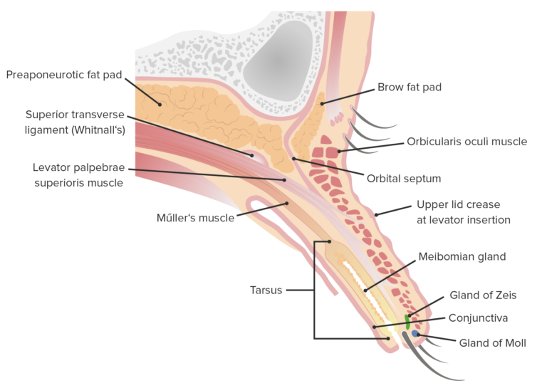 Hordeolo Hordéolo (Terçolho) | Concise Medical Knowledge