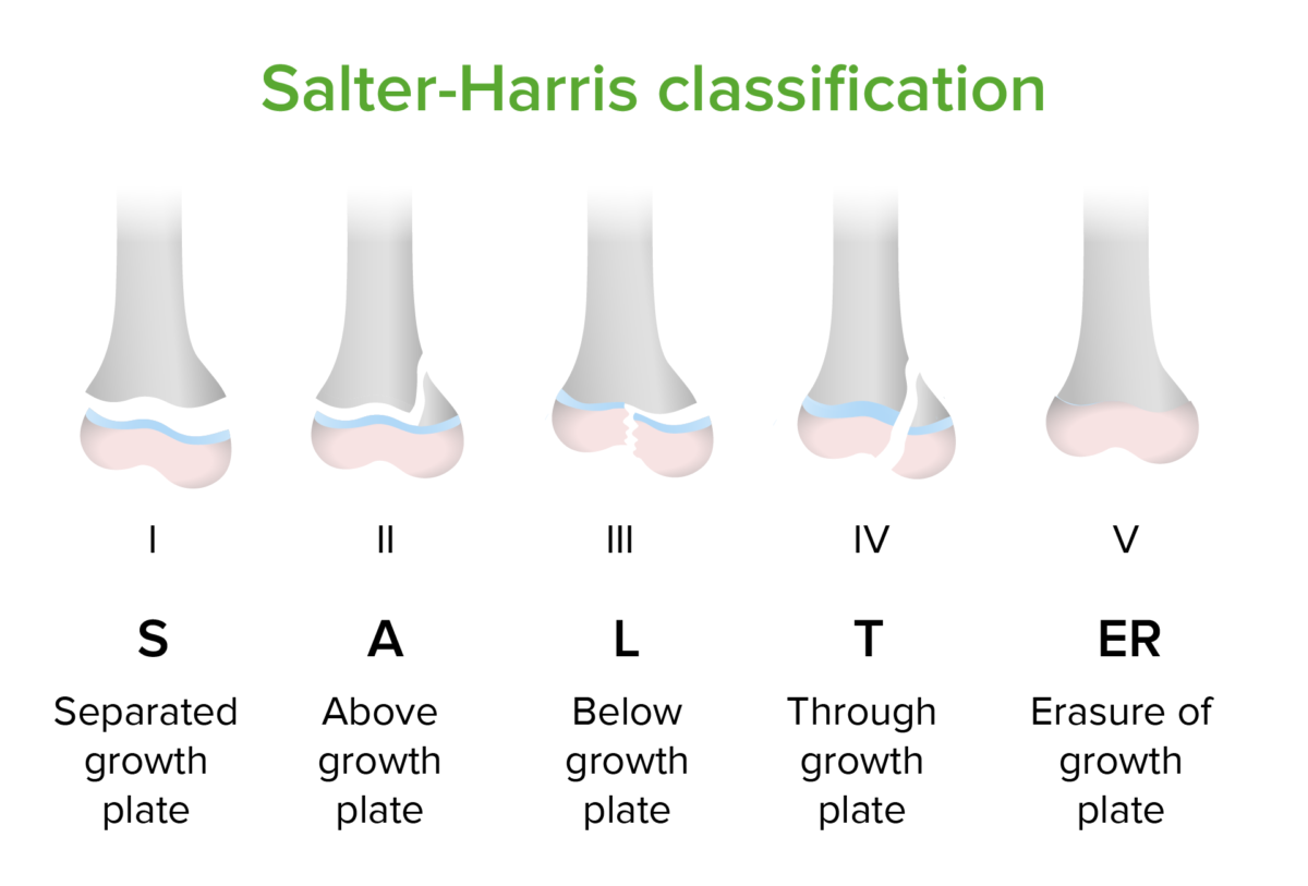Salter-harris classification