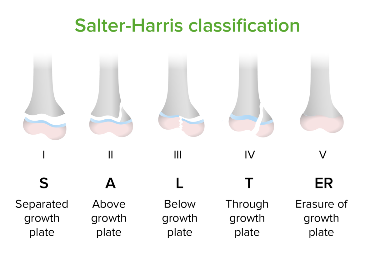 Classificação salter-harris