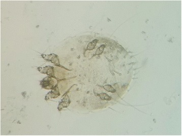 Scabies mite