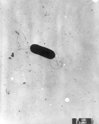Scanning electron micrograph of listeria monocytogenes bacterium