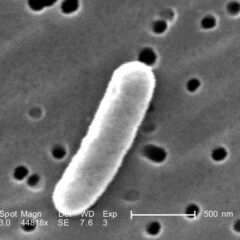 Scanning electron microscope image of Enterotoxigenic Escherichia coli