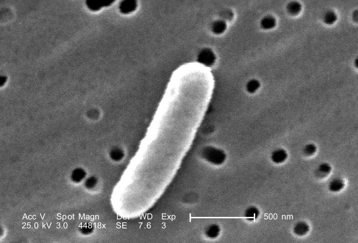 Scanning electron microscope image of enterotoxigenic escherichia coli
