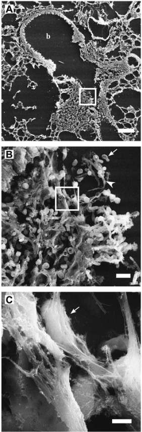 Scanning electron microscope image of nets - neutropenia