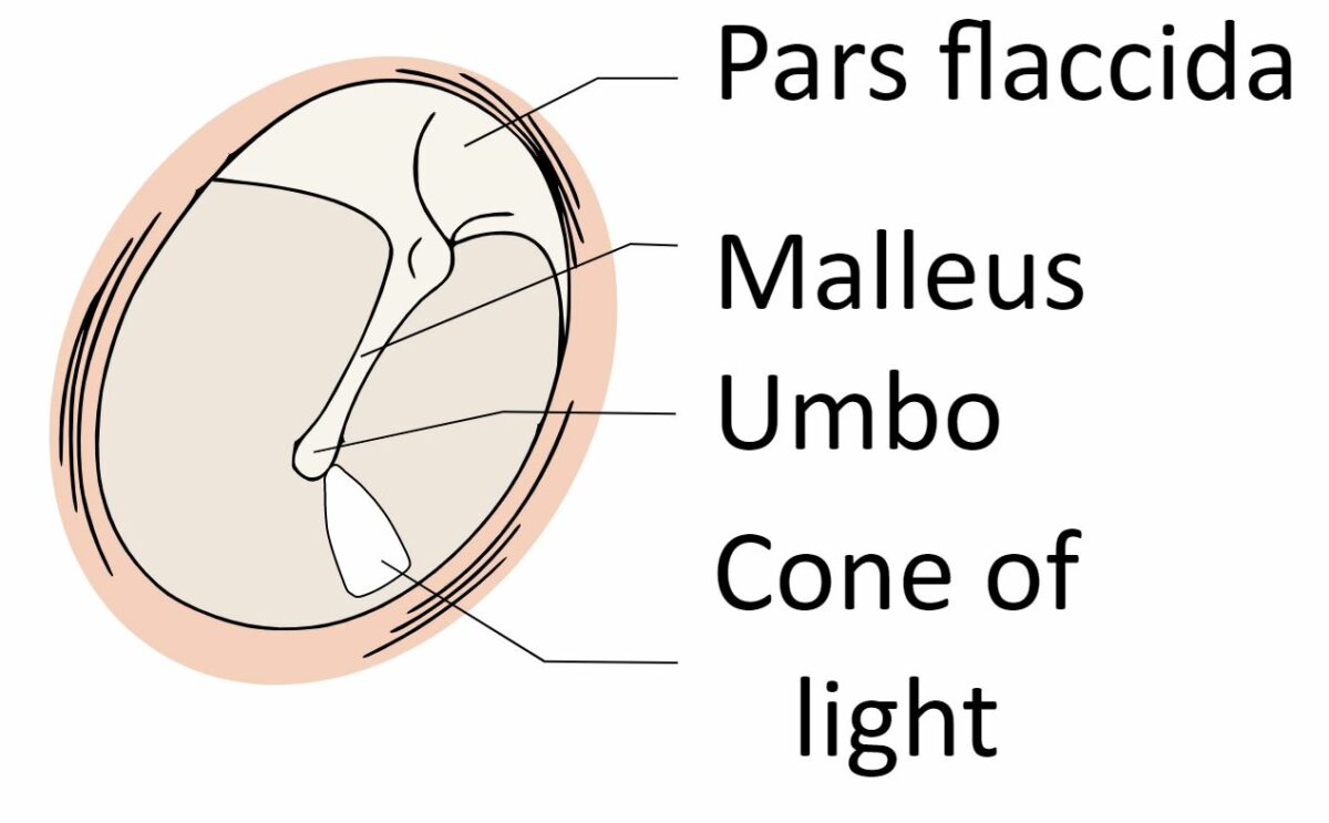 Schematic of the normal tympanic membrane
