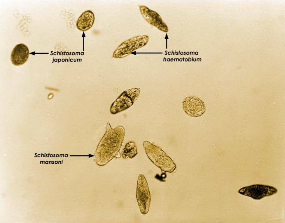 Ovos de schistosoma