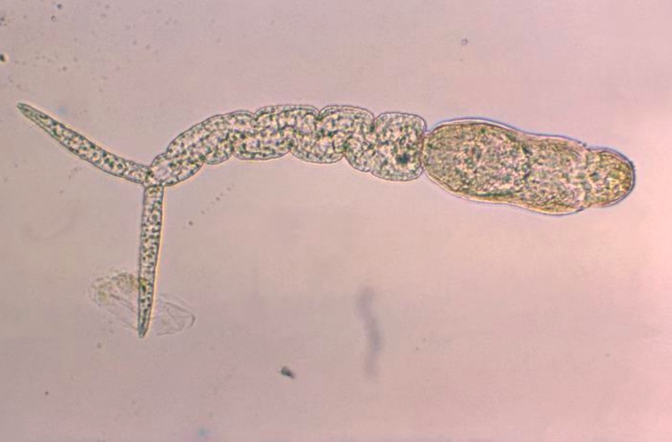 schistosoma mansoni