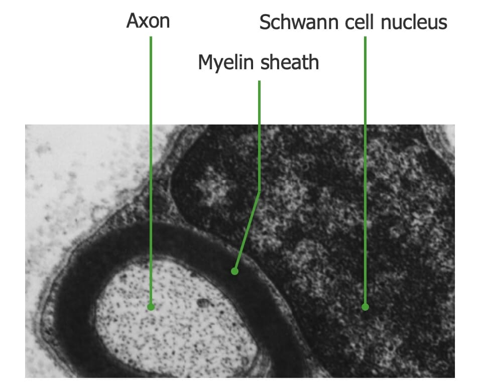 Myelinated axon