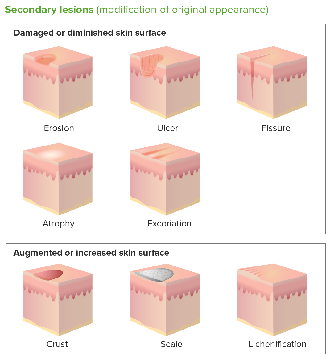 Secondary skin lesions