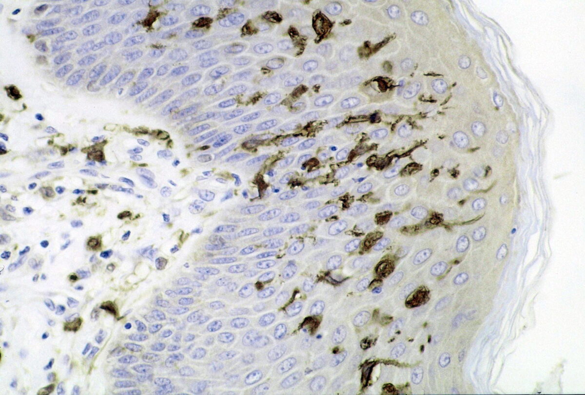 Section of skin showing large numbers of dendritic (langerhans) cells in the epidermis