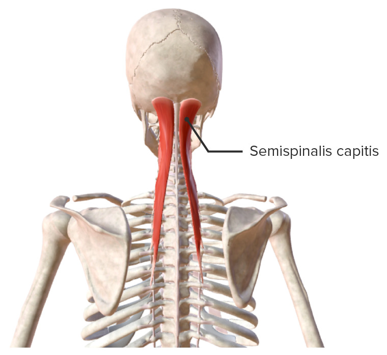 Semispinalis capitis