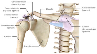 Clavicle Fracture | Concise Medical Knowledge