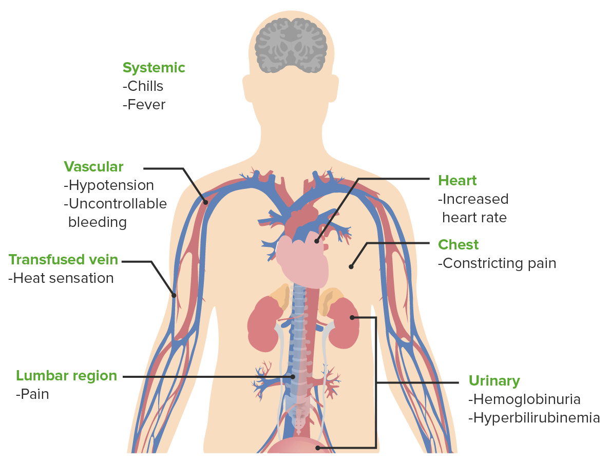 Signs and symptoms of acute hemolytic transfusion reactions