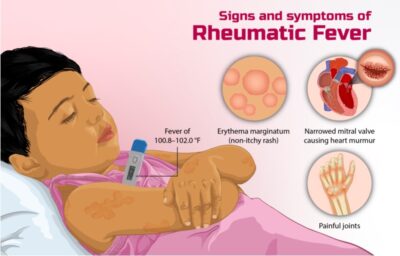 rheumatic demam reumatik simptom punca rawatan