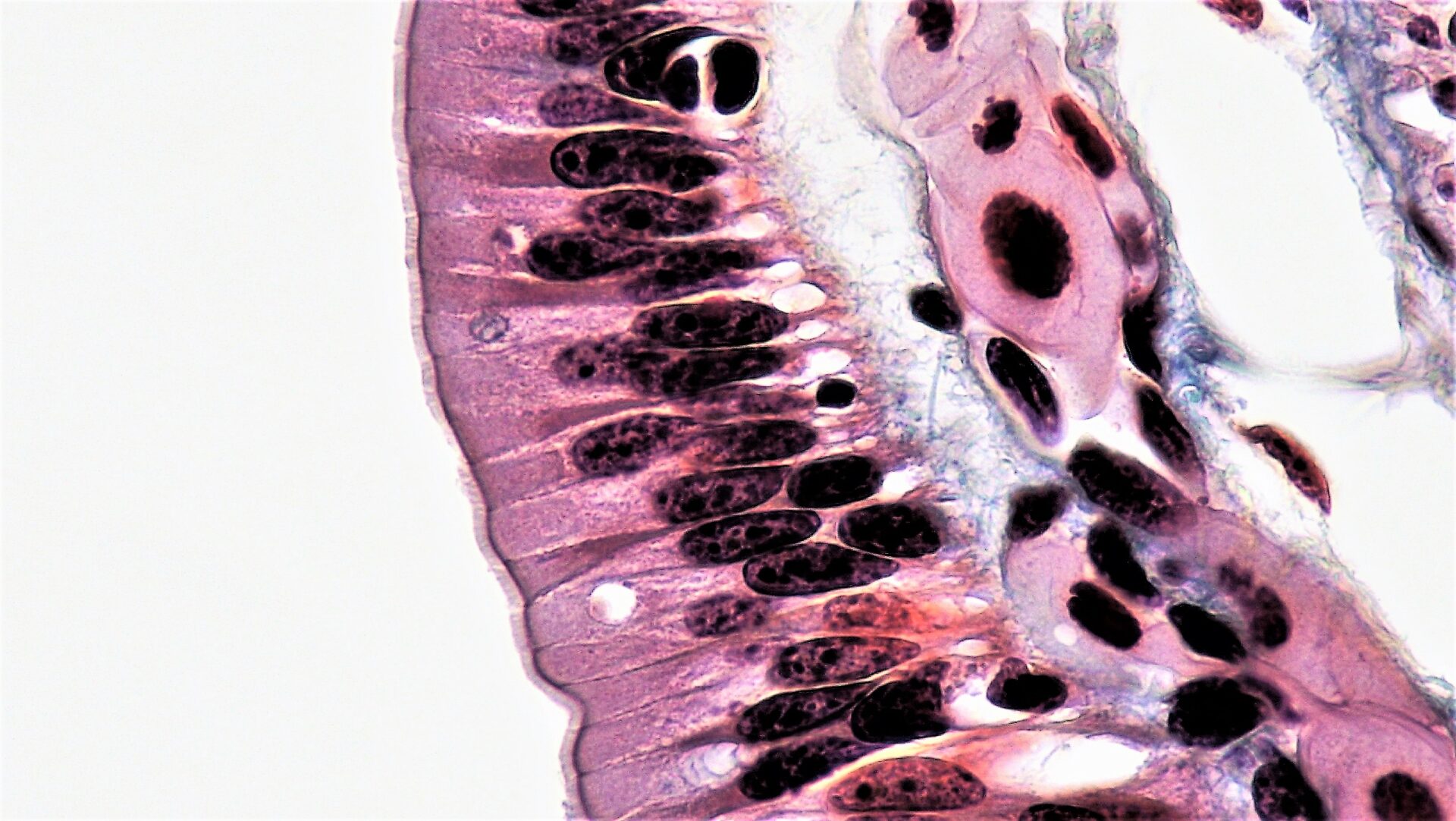 Surface Epithelium: Histology | Concise Medical Knowledge