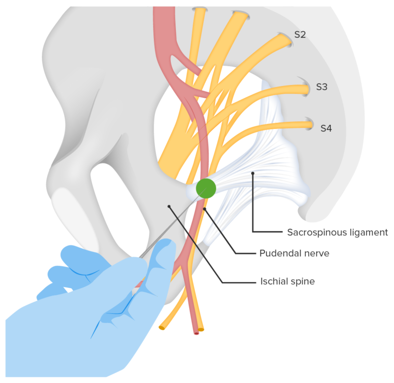 Obstetric Pain Management | Concise Medical Knowledge