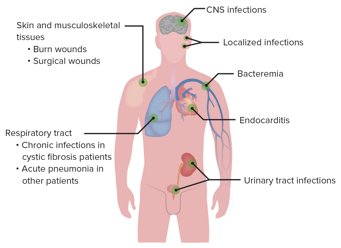 Pseudomonas Concise Medical Knowledge