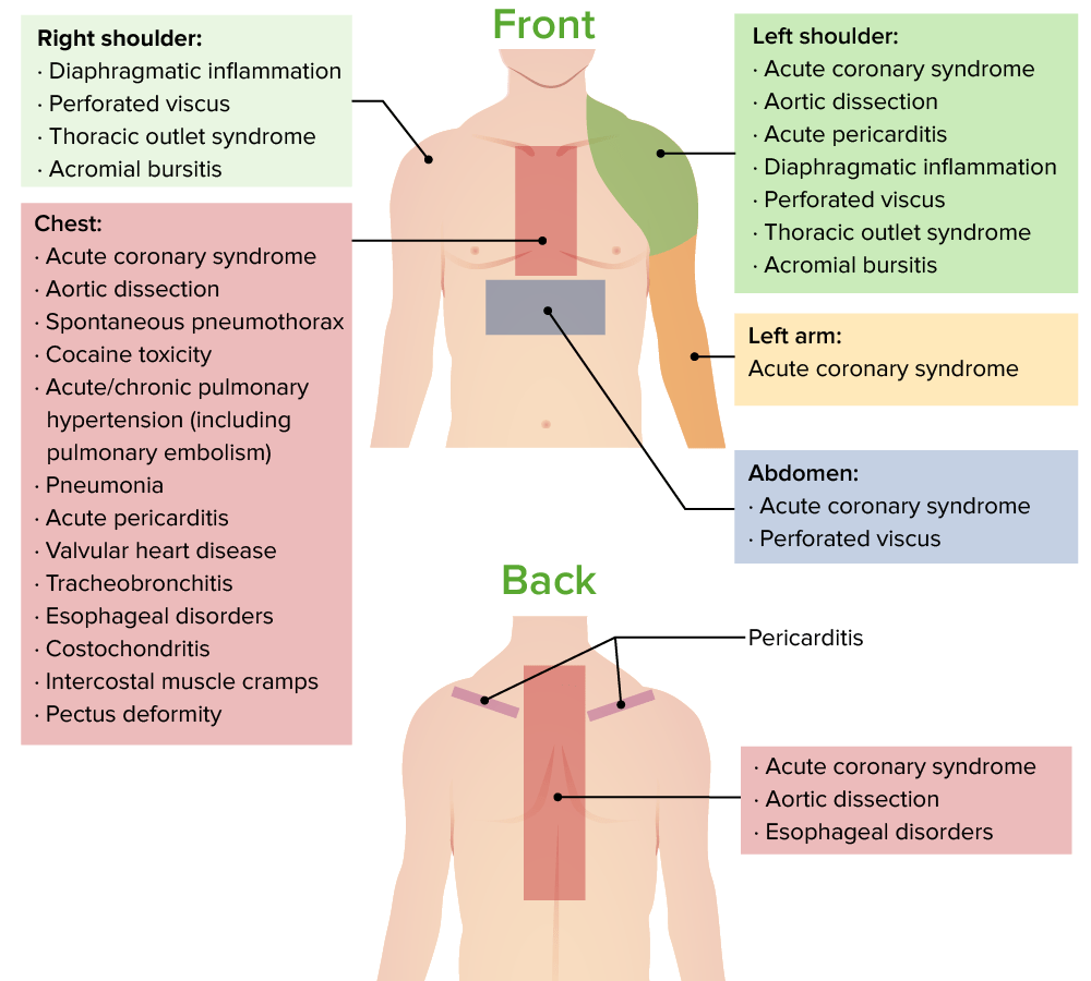 Sites of referred pain in the chest
