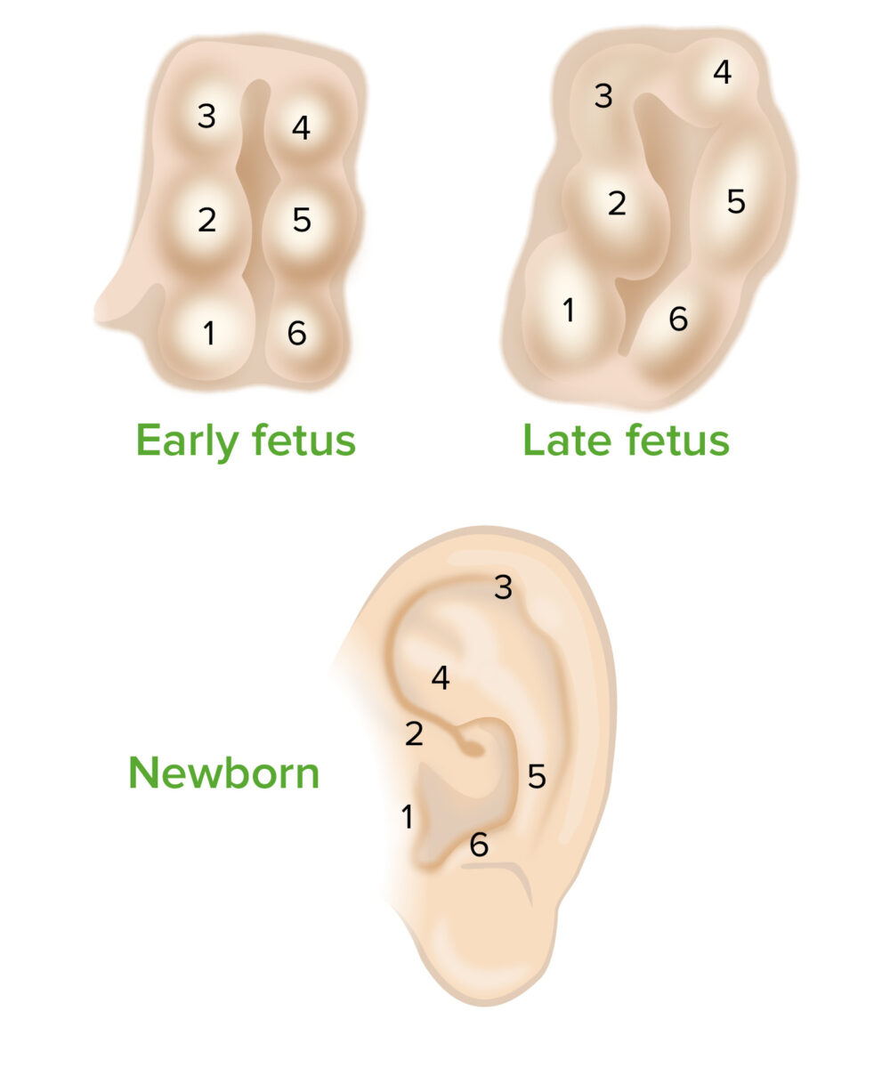 Six auricular hillocks bulge outward from the pharyngeal arches and shift to form the characteristic shape of the external ear
