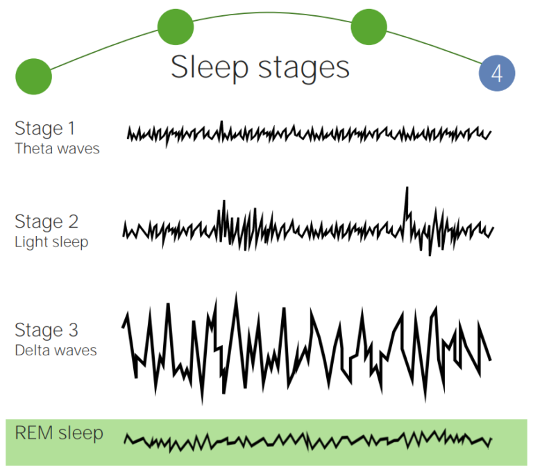 Physiology Of Sleep | Concise Medical Knowledge