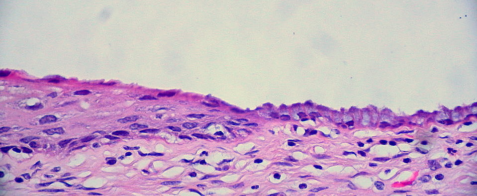 Squamocolumnar junction of the cervix