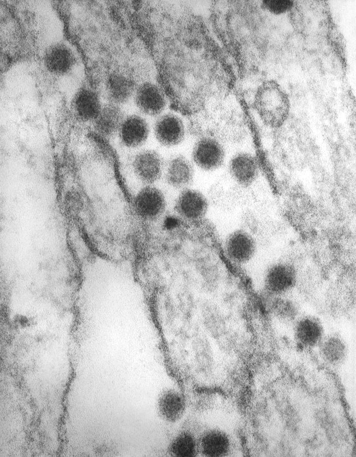 Viriones flaviviridae de encefalitis de st. Louis