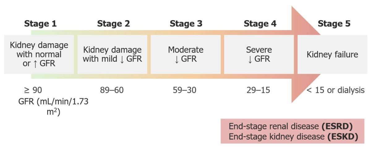 Stages of ckd