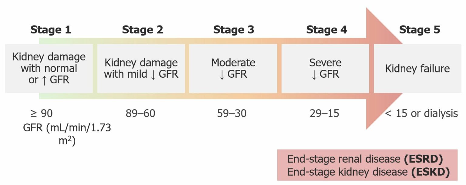Chronic Kidney Disease Concise Medical Knowledge