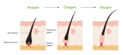 Alopecia | Concise Medical Knowledge