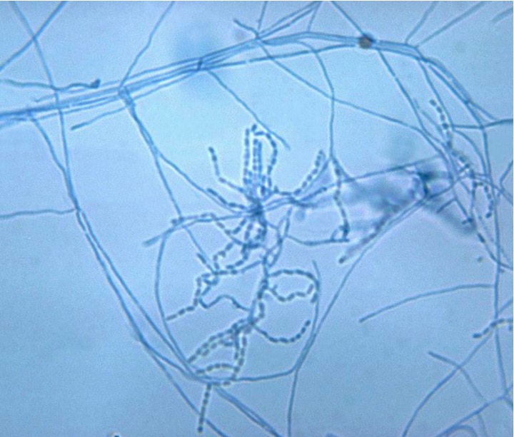 Stain nocardia species