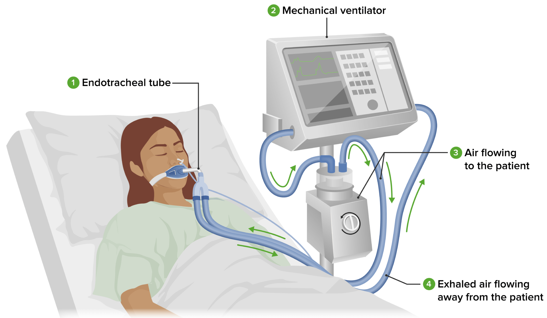 invasive-mechanical-ventilation-concise-medical-knowledge