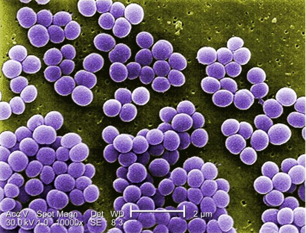 Premium Photo  Staphylococcus aureus antibiotic resistant bacteria