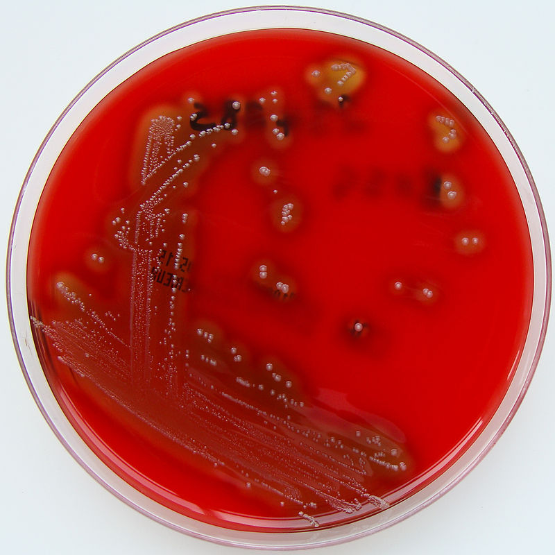 Streptococcus pyogenes (grupo a de lancefield) em ágar sangue de cavalo columbia