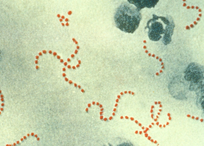 streptococci gram stain