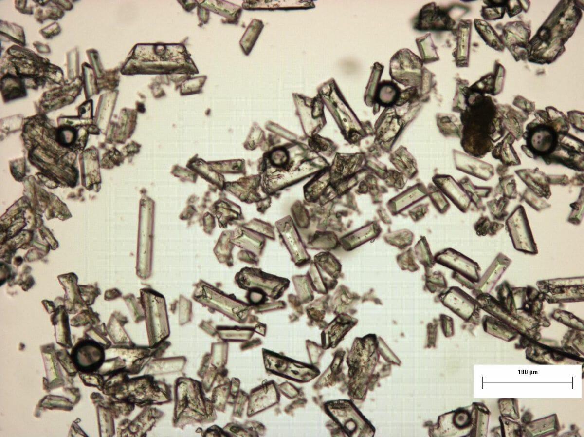 Struvite chrystals under the microscope