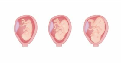 Study embryology