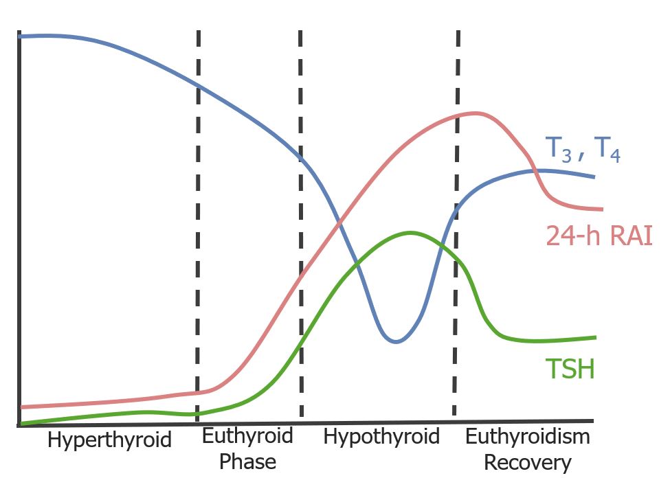 subacute thyroiditis