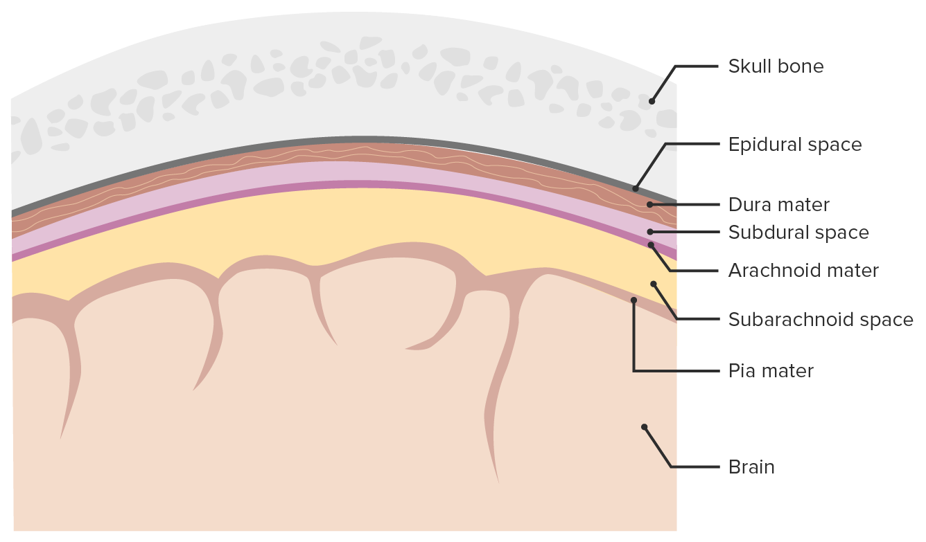 Subarachnoid Hemorrhage (SAH) - Brain, Spinal Cord, and Nerve