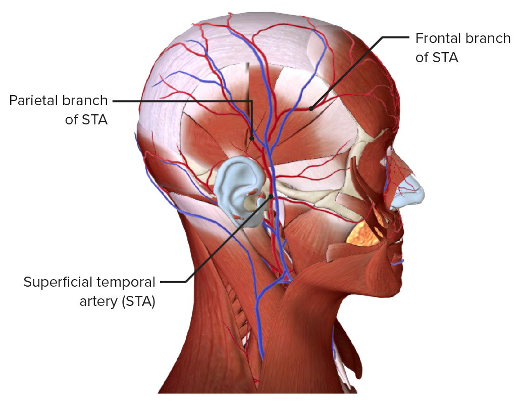 Arteria temporal superficial