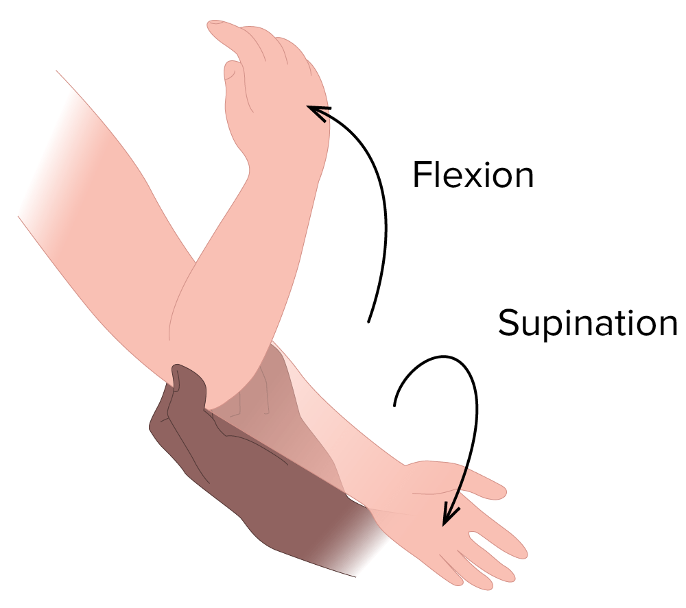 Supination flexion technique