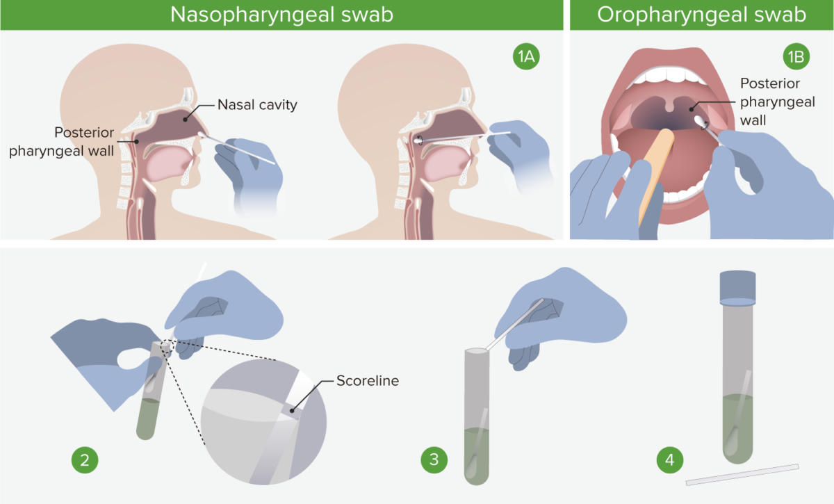 Swabs 3 new