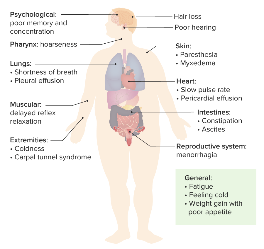 Symptoms and signs of hypothyroidism
