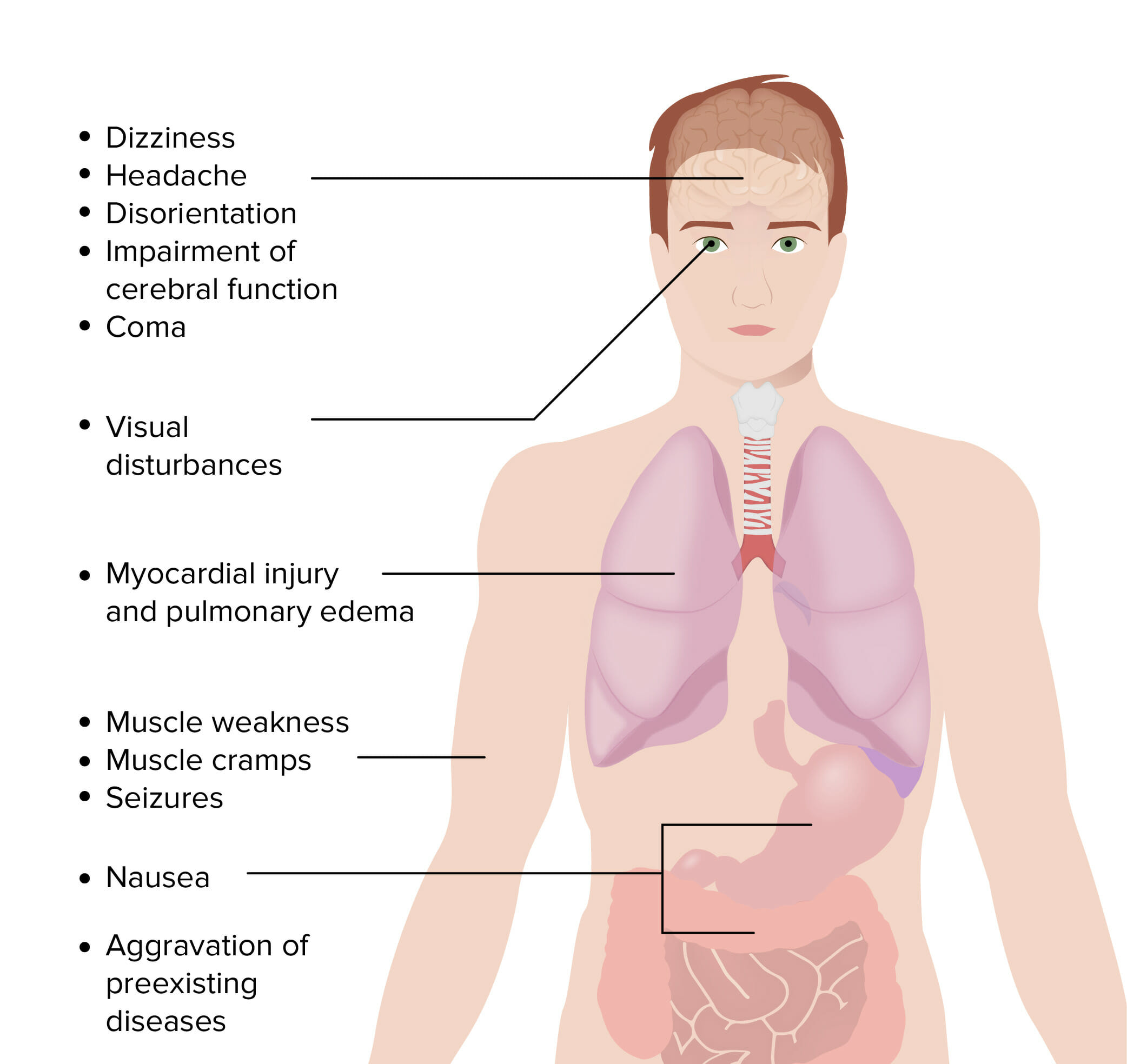 Carbon Monoxide Poisoning Concise Medical Knowledge   Symptoms Of Carbon Monoxide Poisoning 