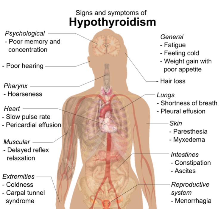 Sintomas de hipotiroidismo