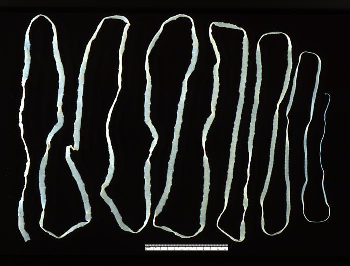 Taenia saginata tapeworm