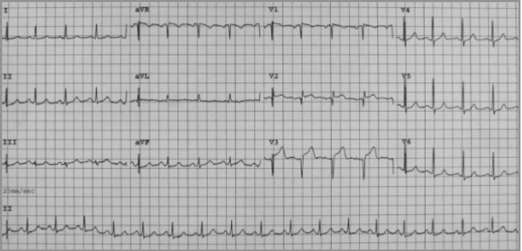 Tako hotsell tsubo ecg