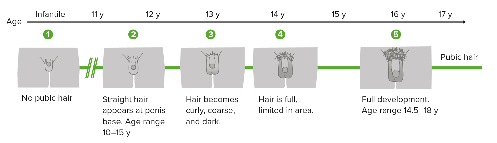 Delayed Puberty Concise Medical Knowledge